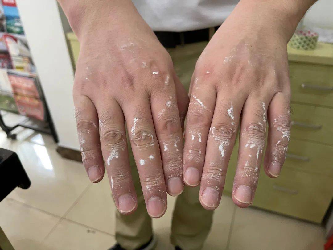 六安第二轮全员核酸检测均为阴性/六安核酸检测第三轮 六安第二轮全员核酸检测均为阴性/六安核酸检测第三轮