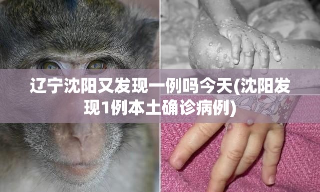 辽宁沈阳又发现一例吗今天(沈阳发现1例本土确诊病例) 辽宁沈阳又发现一例吗今天(沈阳发现1例本土确诊病例)