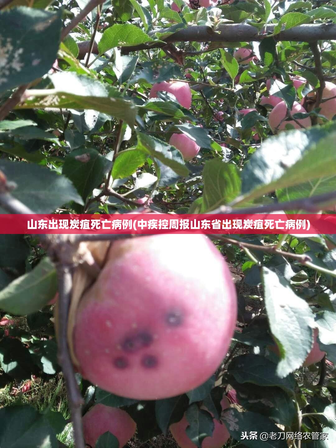 山东出现炭疽死亡病例(中疾控周报山东省出现炭疽死亡病例) 山东出现炭疽死亡病例(中疾控周报山东省出现炭疽死亡病例)