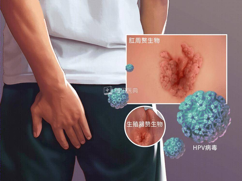 南京病毒/南京病毒尤肛门尖锐湿视频 南京病毒/南京病毒尤肛门尖锐湿视频
